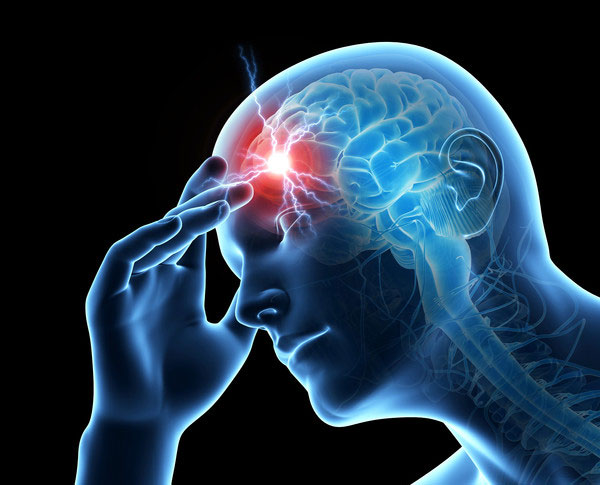 Featured image for “Migraine Headaches”